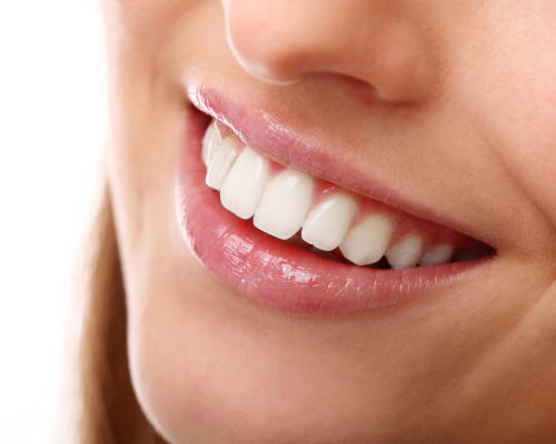 In-Clinic Whitening Mysore